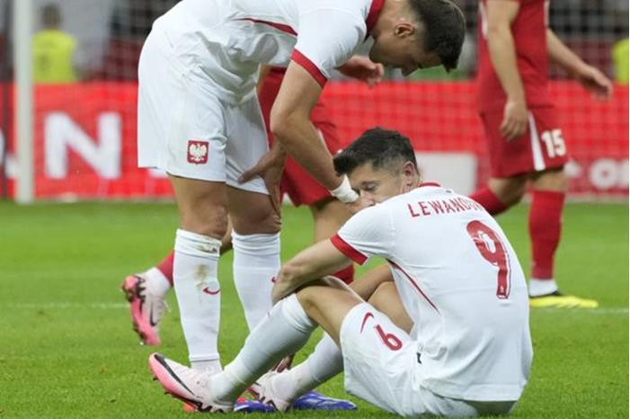 كشف حجم إصابة ليفاندوفسكي قبل أيام من انطلاق يورو 2024 66683af94c59b701424c457b