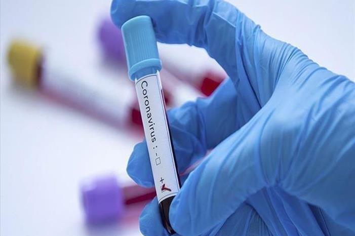 2020_5_11_10_55_45_355