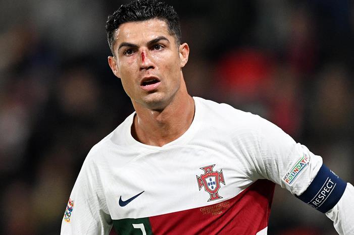 Cristiano_Ronaldo_Portugal_Czech_Republic_injury_2022
