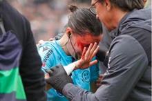 65dc2c954236043cf8603fca